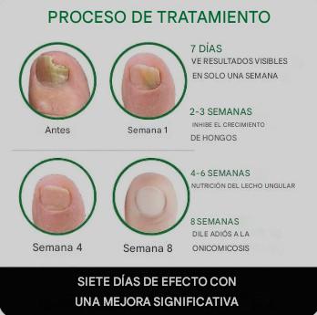 Gotas 7 días antihongos para pies™