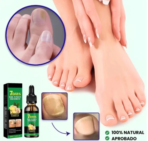 Gotas 7 días antihongos para pies™
