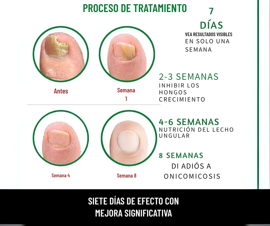 Gotas 7 días antihongos para pies™