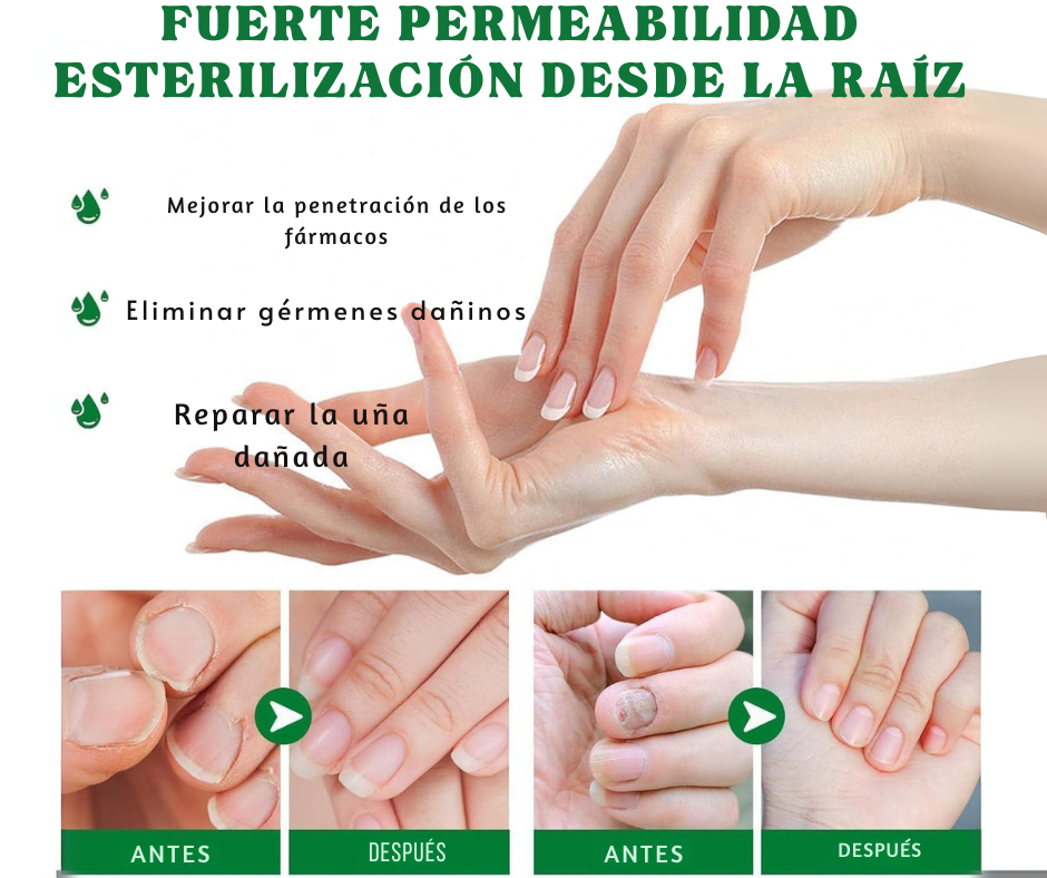 Gotas 7 días antihongos para pies™