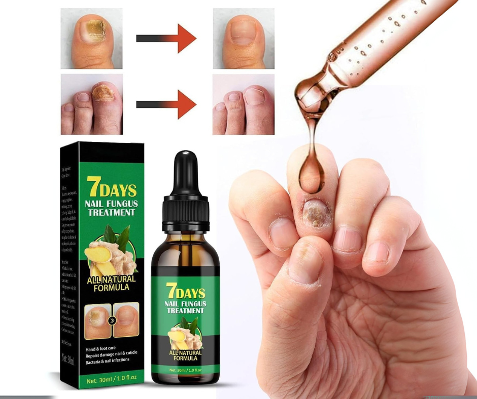 Gotas 7 días antihongos para pies™