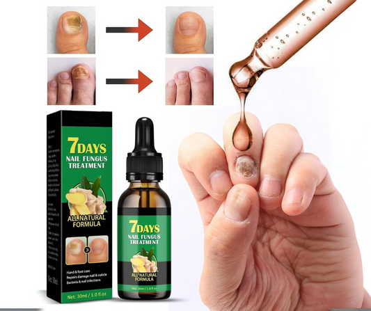 Gotas 7 días antihongos para pies™