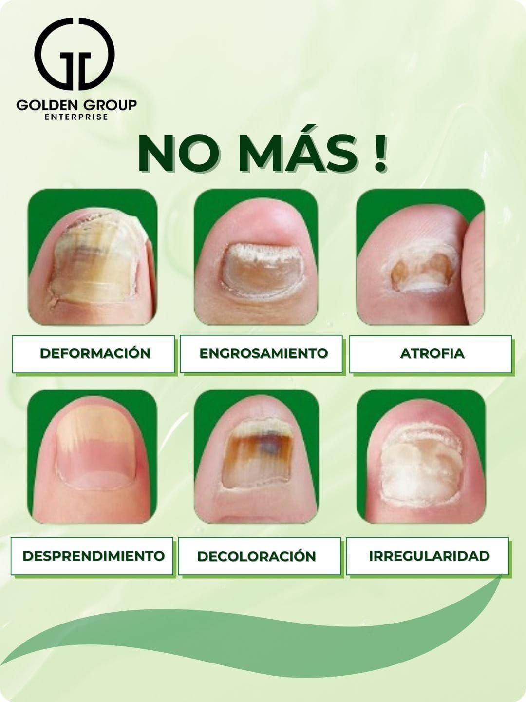 Gotas 7 días antihongos para pies™